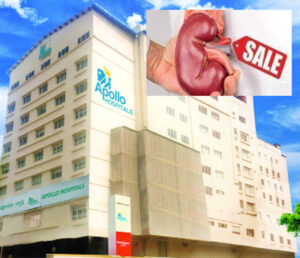 More than 1200 kidneys were sold in Apollo Hospital